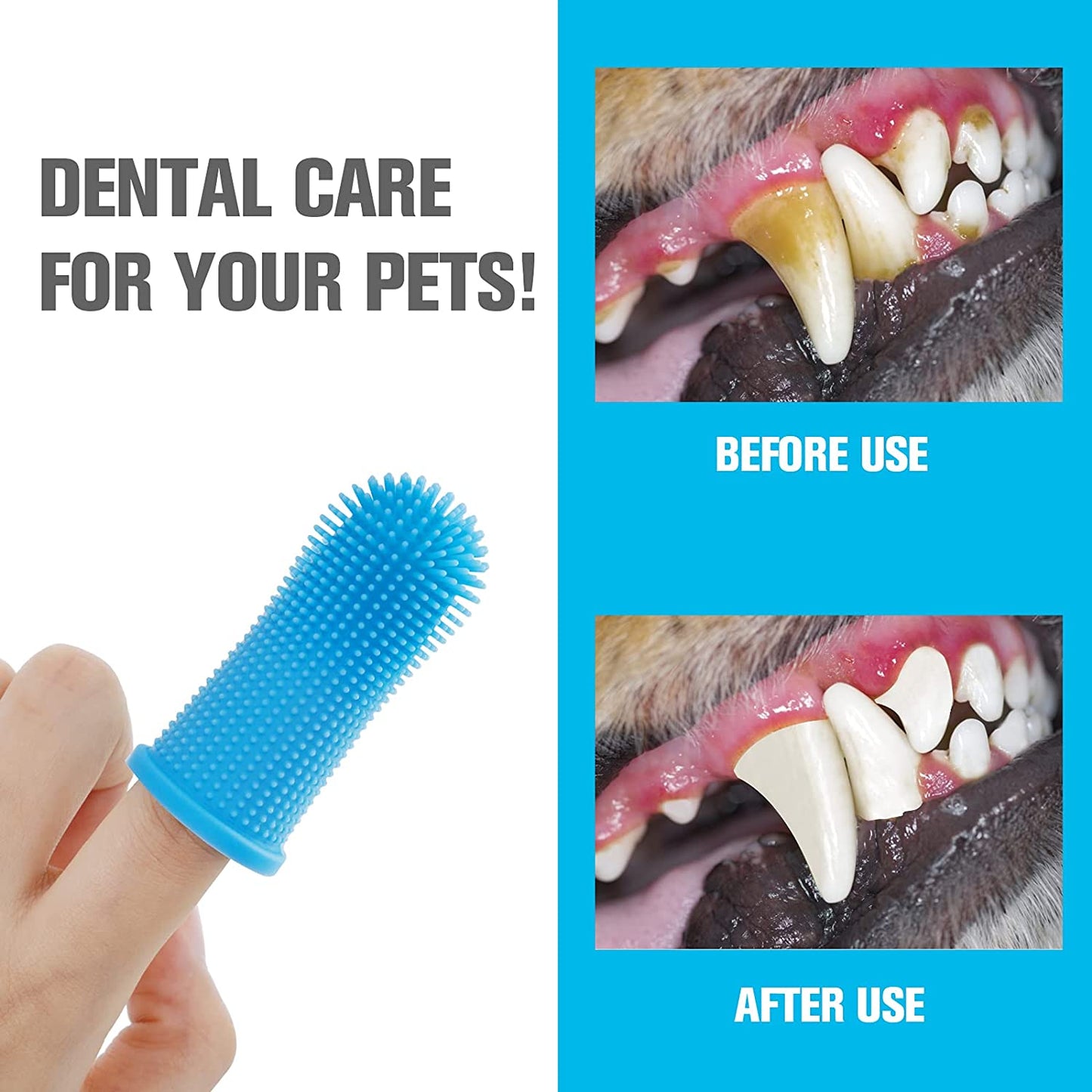 DentaFlex Silicone Finger Toothbrush